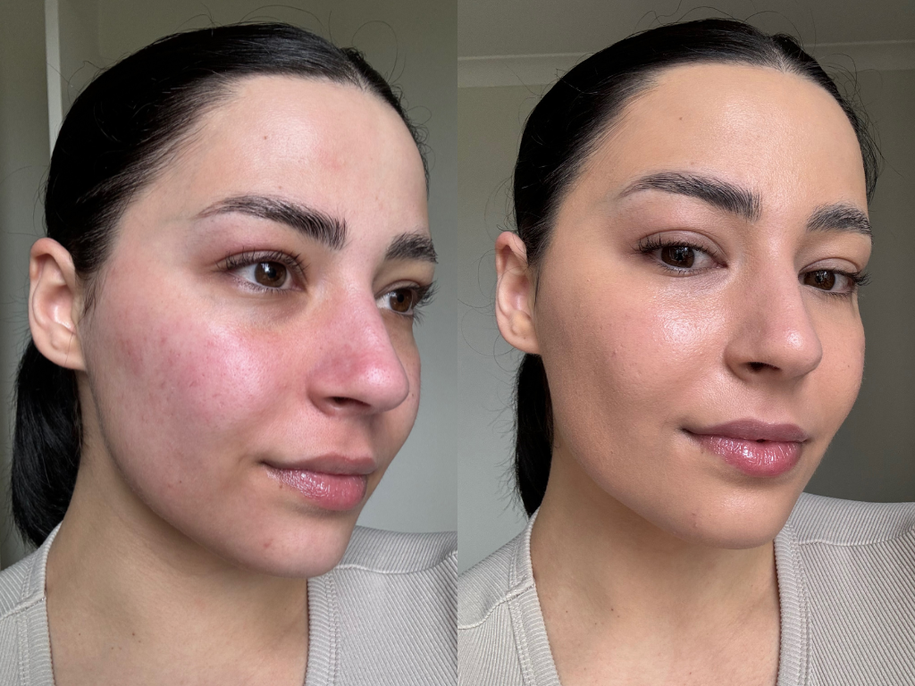 Vitamin C Serum Results