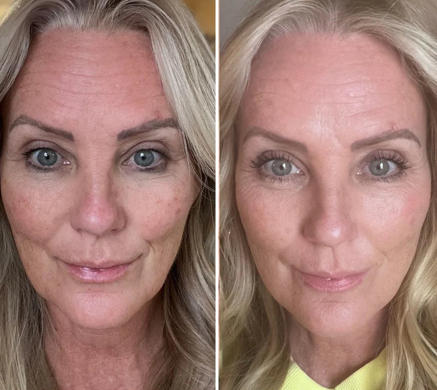 Before and After Results