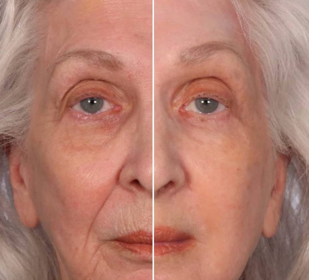 The 10 Best Wrinkle Products of 2025